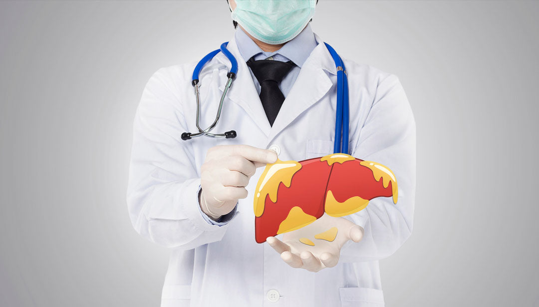 Ein Mann mit Stetoskop und Mundschutz hält eine Fettleber in der Hand.