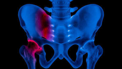 Wo befindet sich das Iliosakralgelenk?