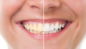 © iStockfoto.com / Catalin205