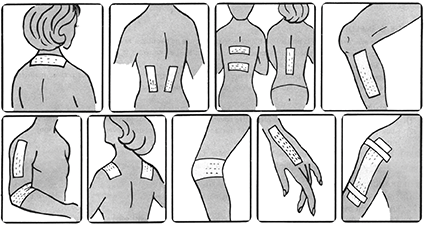 Magnetische Pflaster (6er-Set)