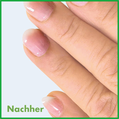Warzen-EX-Tinktur (2er-Set)